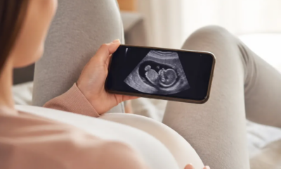 Menino ou Menina? Veja Como Descobrir pelo Celular